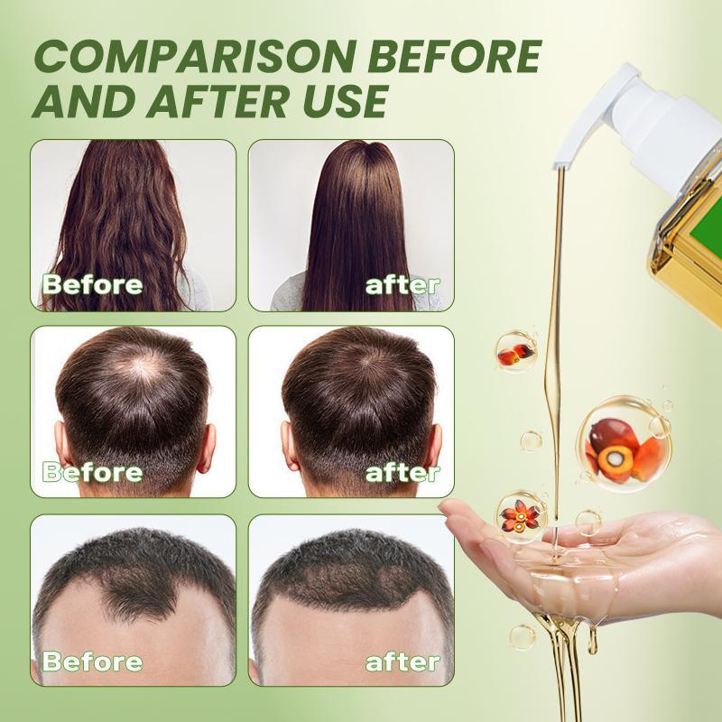 Newyuo Batana Oil & Rosemary Shampoo - Nourishing Volumizing Shampoo for Men and Women - Cleanses the scalp,Reduces hair loss, repairs damage and aids hair growth