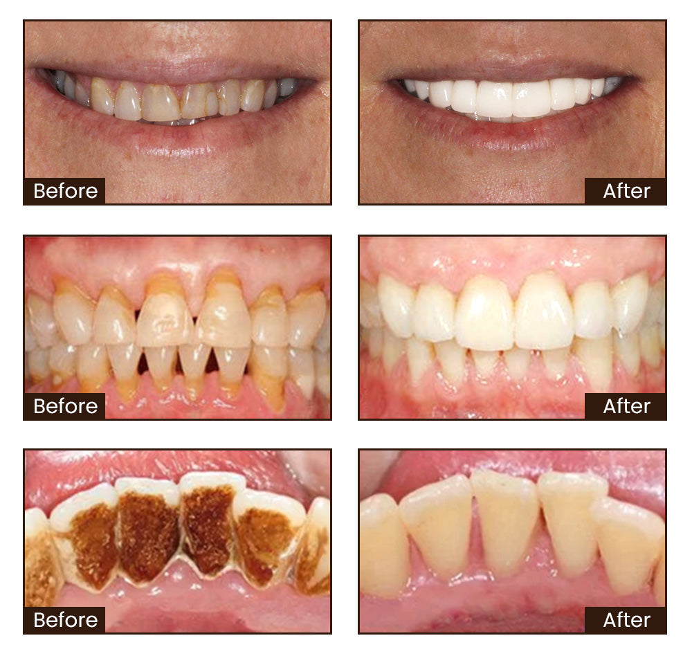 ADA certification-Niacinamide Whitening Toothpaste