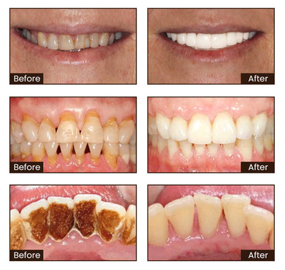 ADA certification-Niacinamide Whitening Toothpaste
